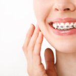 Best Dental Braces Clinic in Kolkata