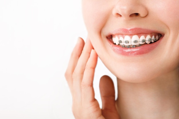 Best Dental Braces Clinic in Kolkata