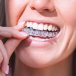 Invisalign Braces Cost in Kolkata