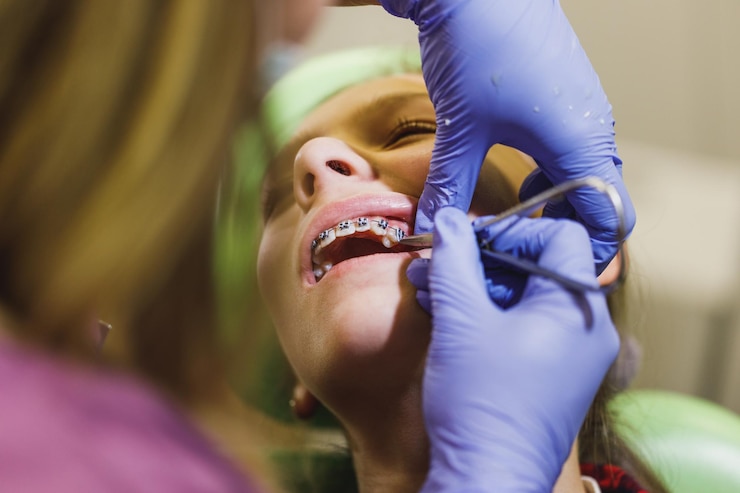 Best Dental Braces Clinic in Kolkata