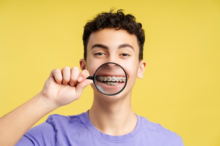 Fixed Braces in Kolkata