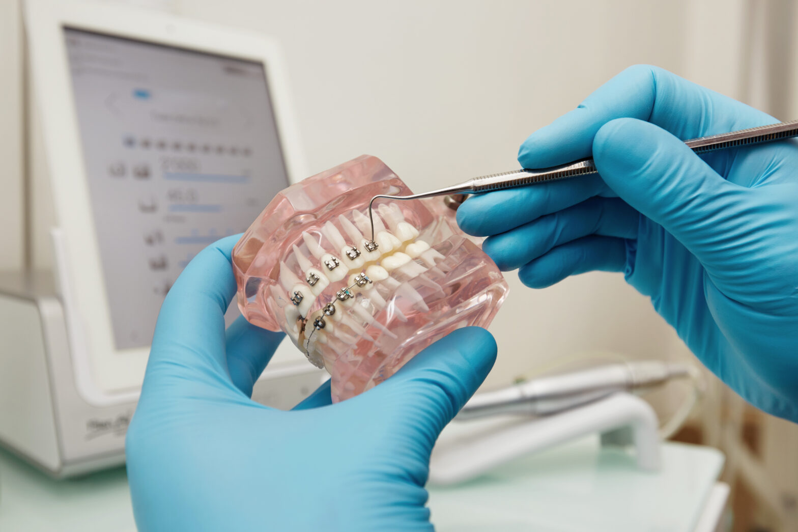 Invisalign Teeth Straightening Kolkata