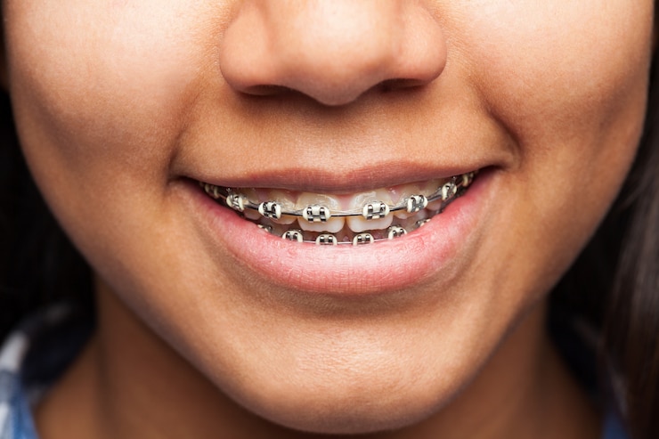braces clinic Kolkata