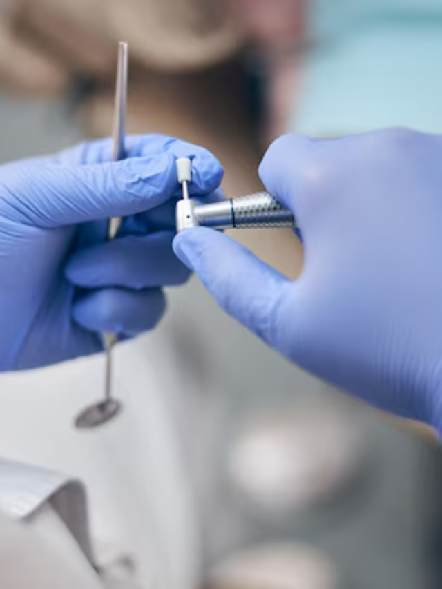 Step-by-Step Guide to Clear Aligner Treatment