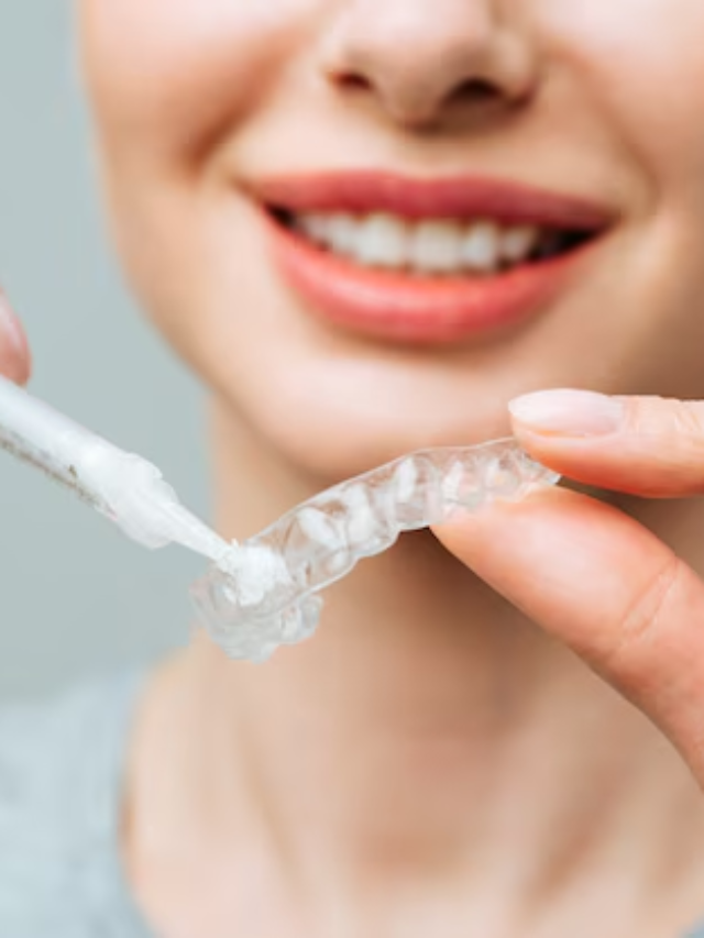 Maintaining Your Clear Aligners: Cleaning and Care Tips