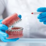 Braces Clinic Kolkata