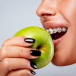 Best Dental Braces Clinic in Kolkata