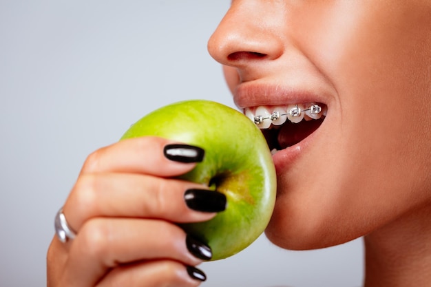 Best Dental Braces Clinic in Kolkata