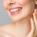 Invisalign Treatment for Adults Kolkata