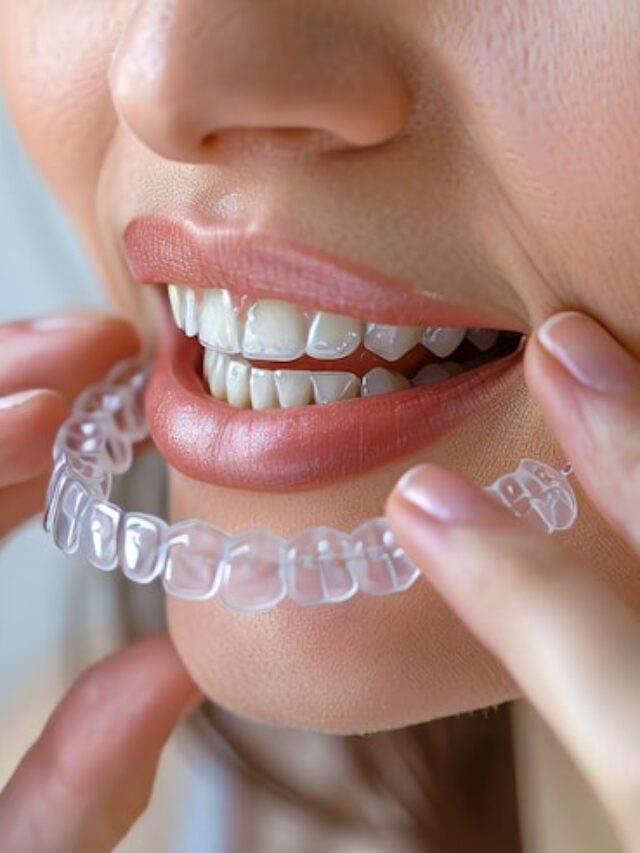 Top-rated clear Aligners in Kolkata